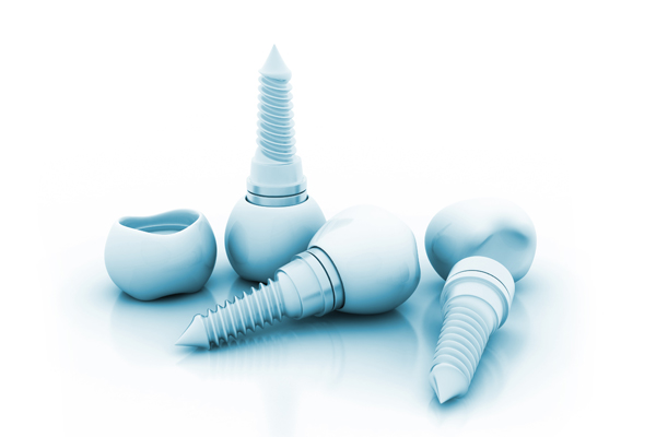Tips For Implant Crown Care