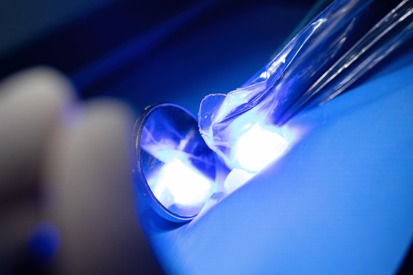 When A Dental Inlay May Be Your Best Restoration Option